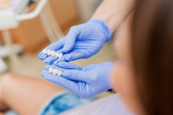 Caring For Your Dental Bridge: Tips For Longevity