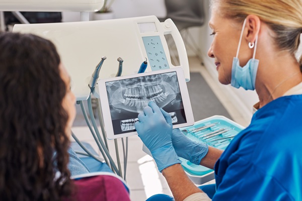 Benefits Of A Tooth Extraction